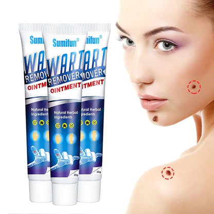 Herbal Warts Remover Cream